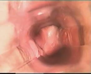Insertion - Speculum Camera Inside Vagina!