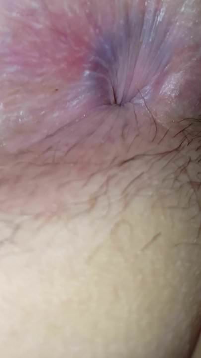 Spreading Wifes hairy ass and hairy pussy
